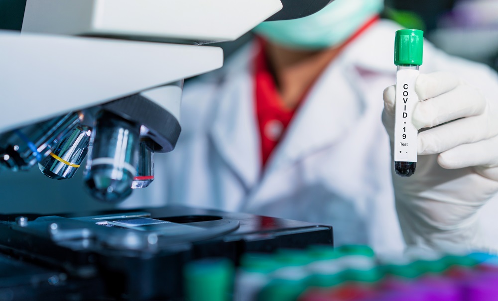 COVID-19: MoPH announces 252 new cases, and 59 new recoveries