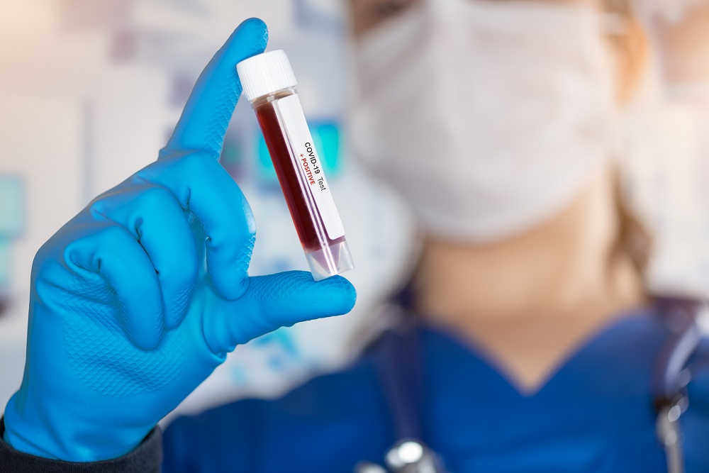 COVID-19: MoPH announces 283 new cases, and 33 new recoveries