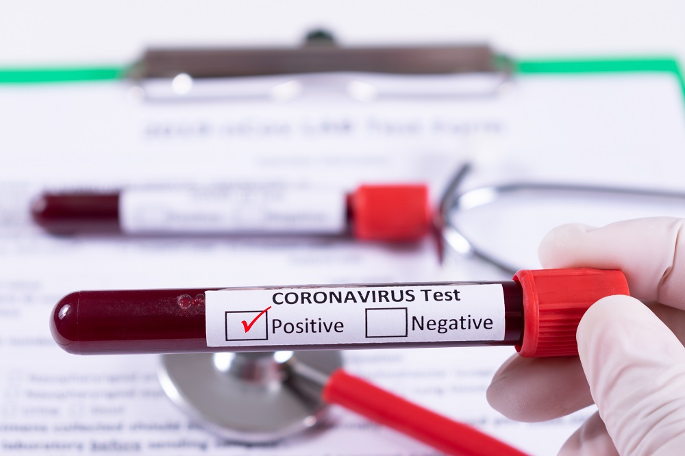 COVID-19: MoPH announces 567 new cases, 37 new recoveries, and 1 death