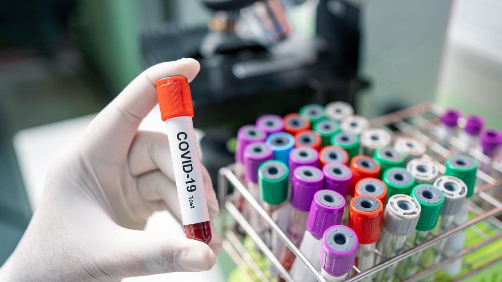 COVID-19: MoPH announces 518 new cases, and 59 new recoveries
