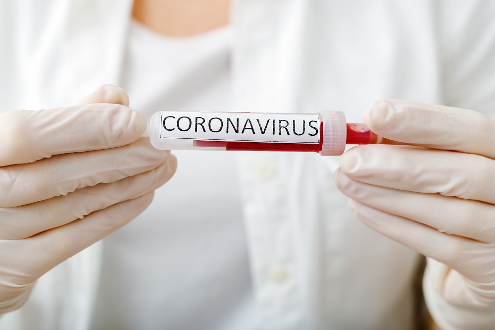COVID-19: MoPH announces 643 new cases, and 109 new recoveries