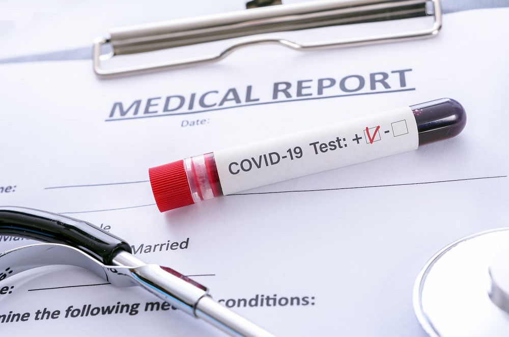 COVID-19: MoPH announces 776 new cases, and 98 new recoveries