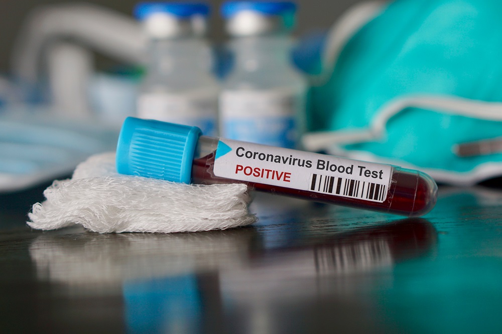 WATCH: COVID-19: MoPH announces 679 new cases, and 130 new recoveries