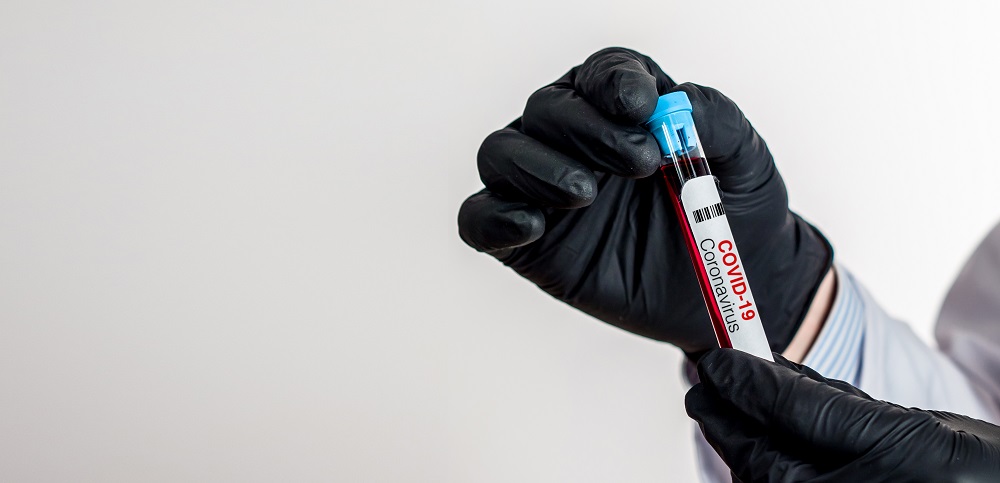 COVID-19: MoPH announces 1526 new cases, and 179 new recoveries