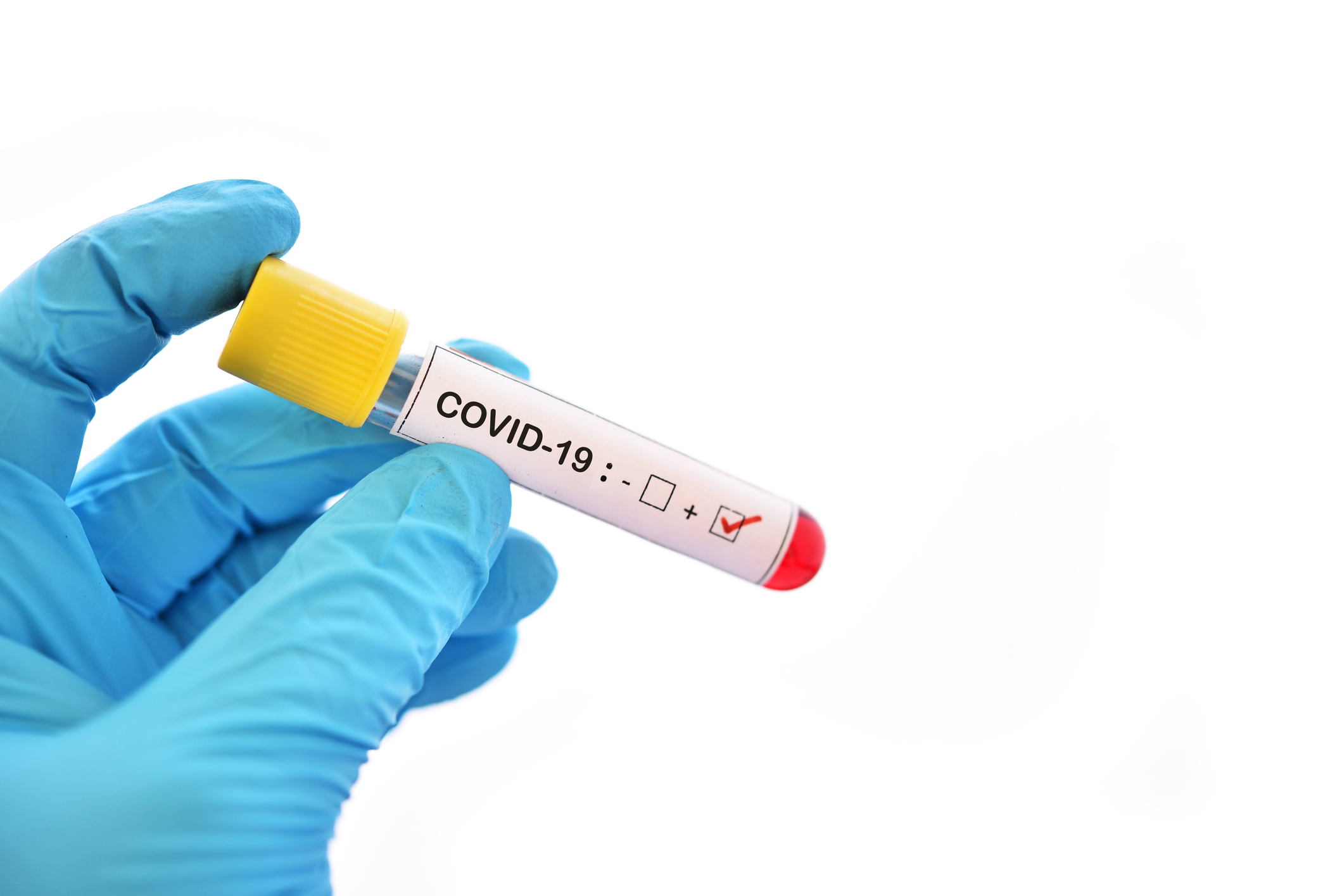 COVID-19: MoPH announces 693 new cases, 1468 new recoveries and three deaths