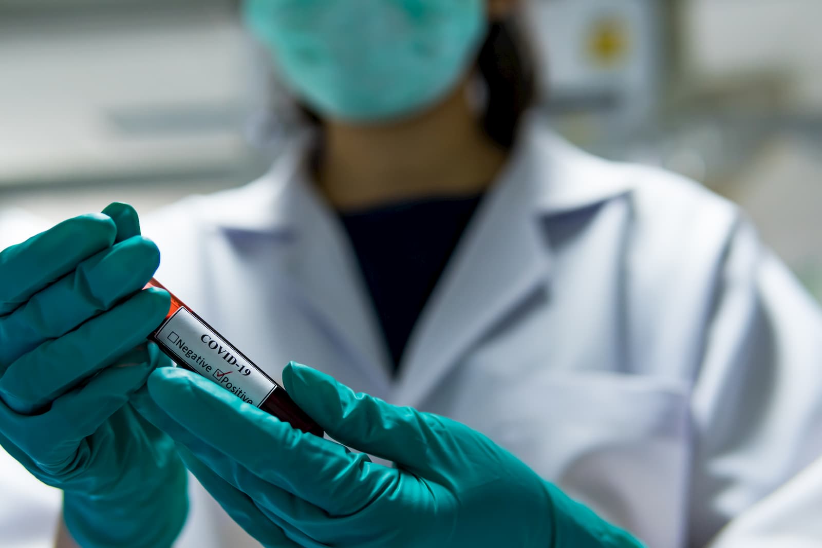 COVID-19: MoPH announces 546 new cases, 1614 new recoveries and five deaths