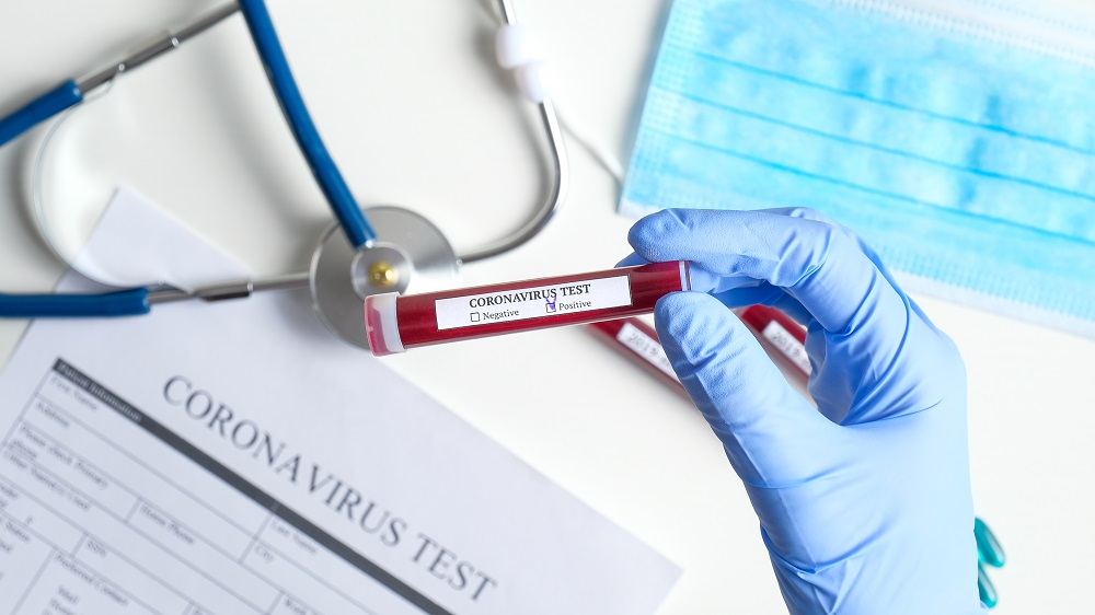 COVID-19: MoPH announces 517 new cases, 533 new recoveries and one death