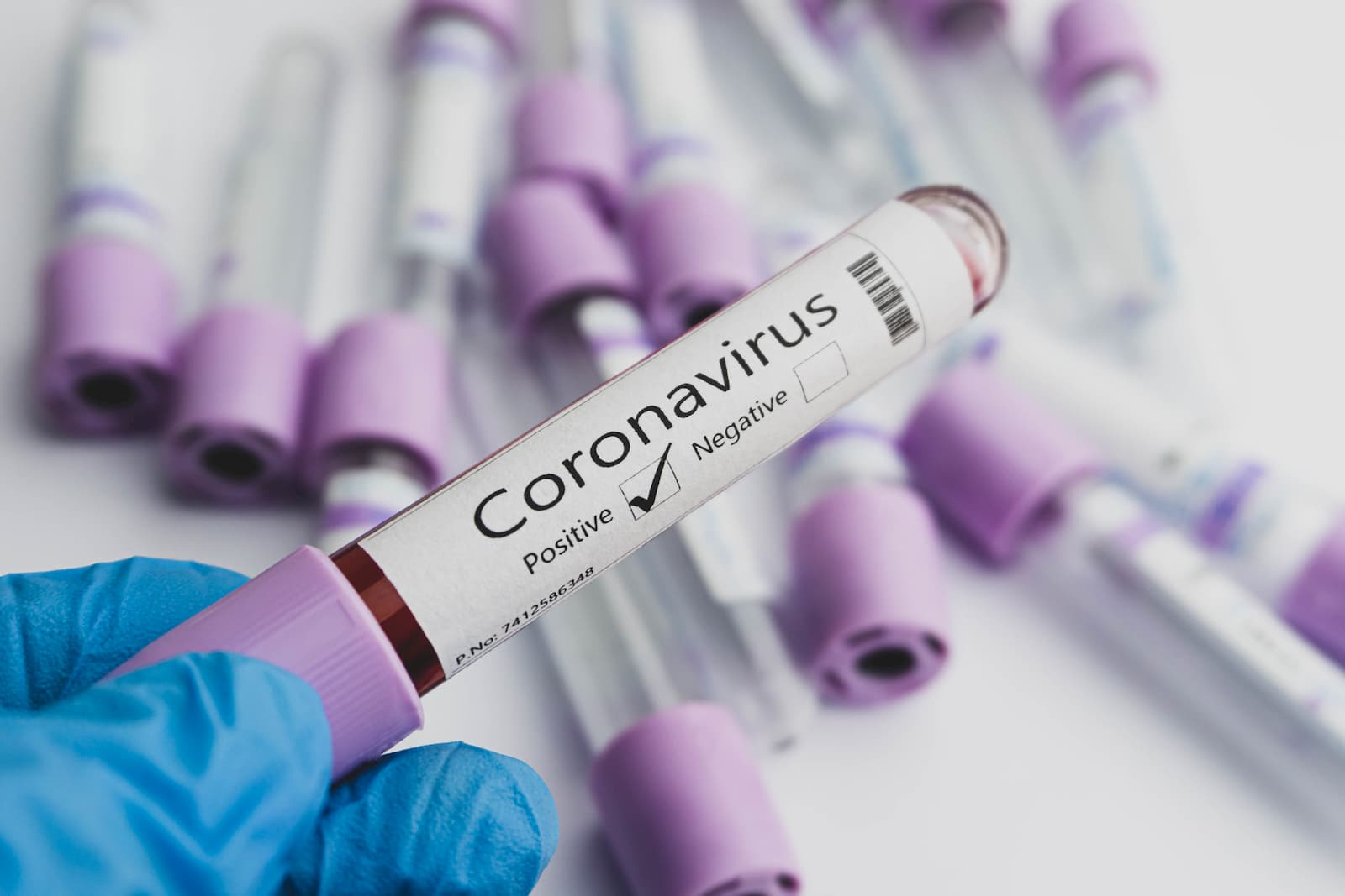 COVID-19: MoPH announces 421 new cases, 429 new recoveries and one death