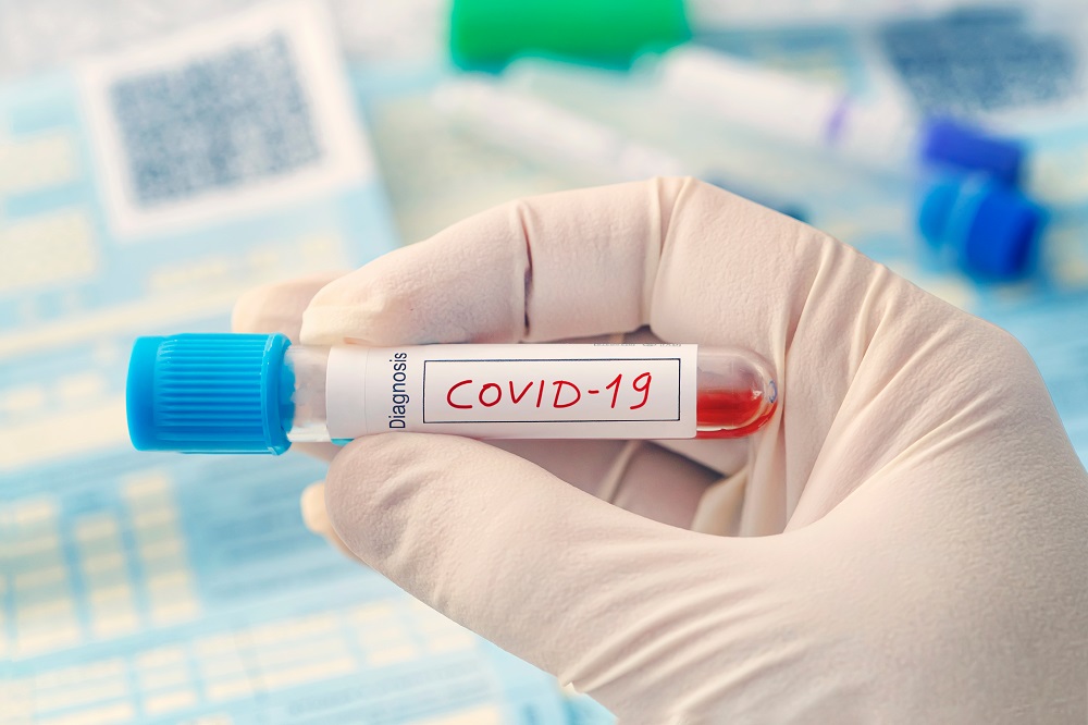 COVID-19: MoPH announces 214 new cases, 202 new recoveries and two deaths