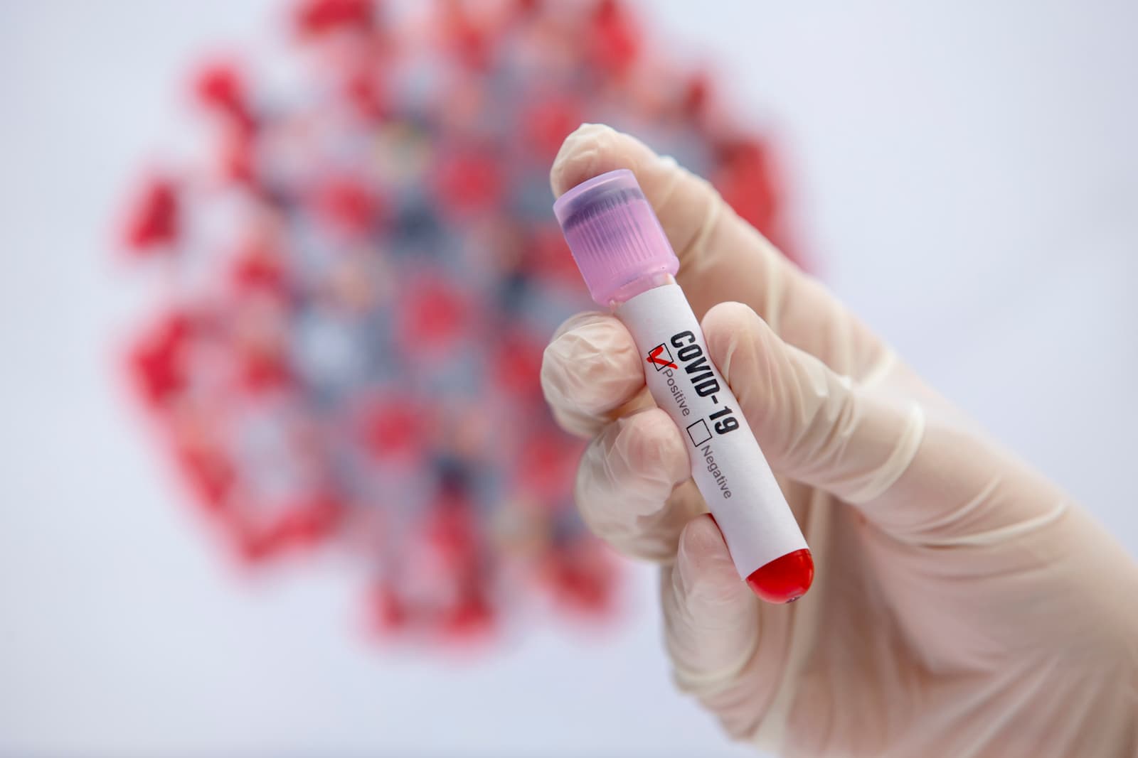 COVID-19: MoPH announces 250 new cases and 257 new recoveries