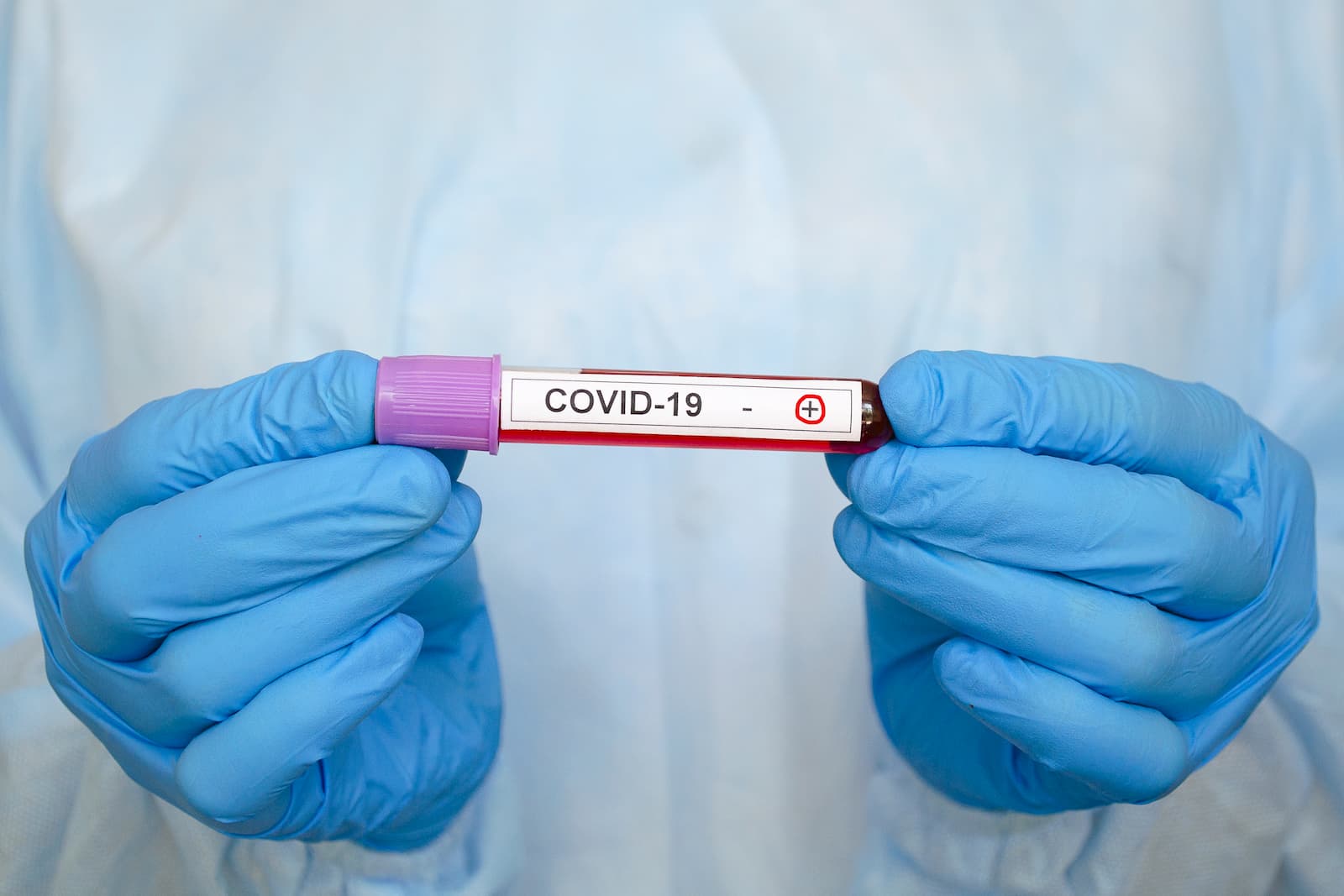 COVID-19: MoPH announces 178 new cases and 208 new recoveries