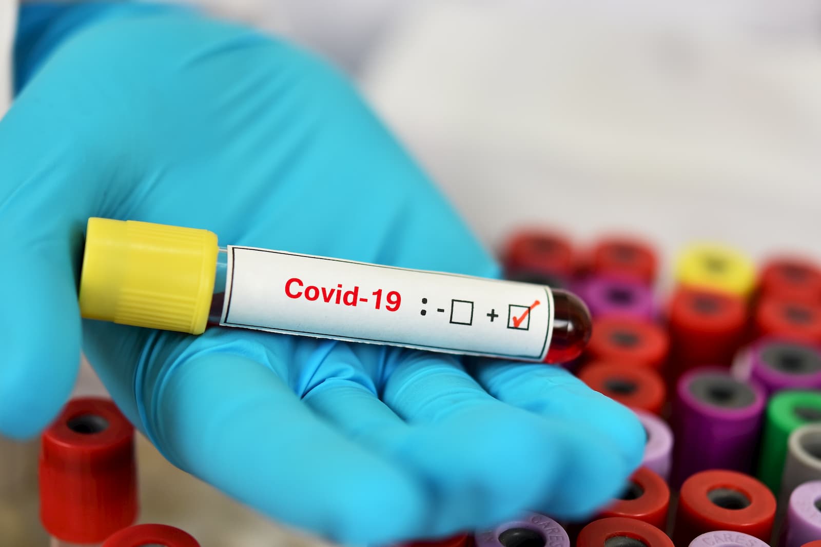 COVID-19: MoPH announces 166 new cases and 131 new recoveries