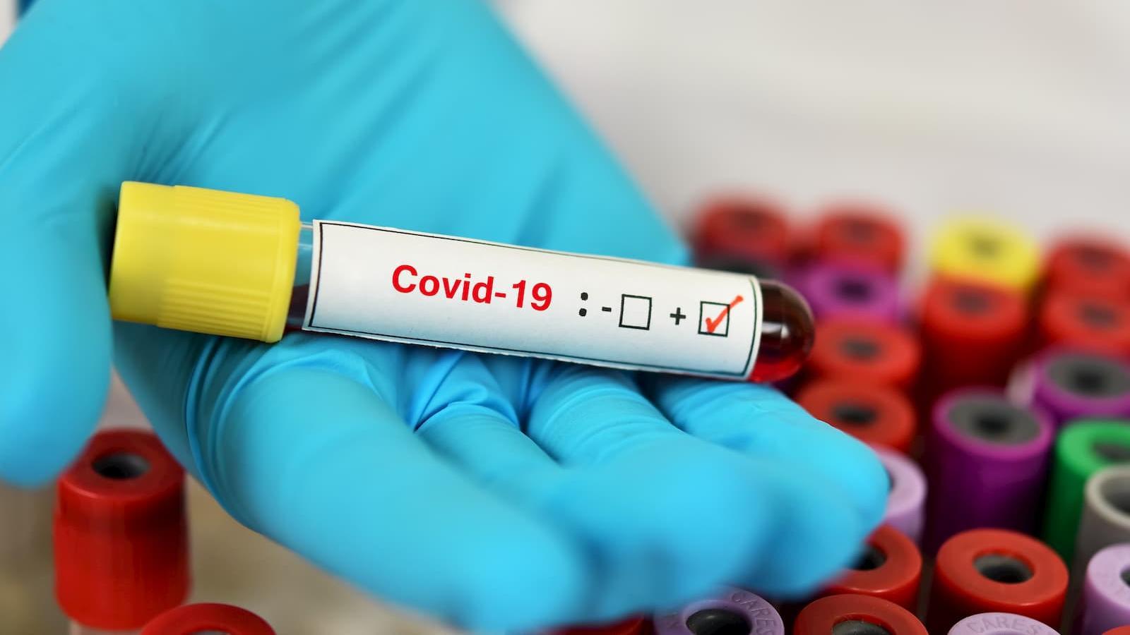 COVID-19: MoPH announces 147 new cases and 153 recoveries