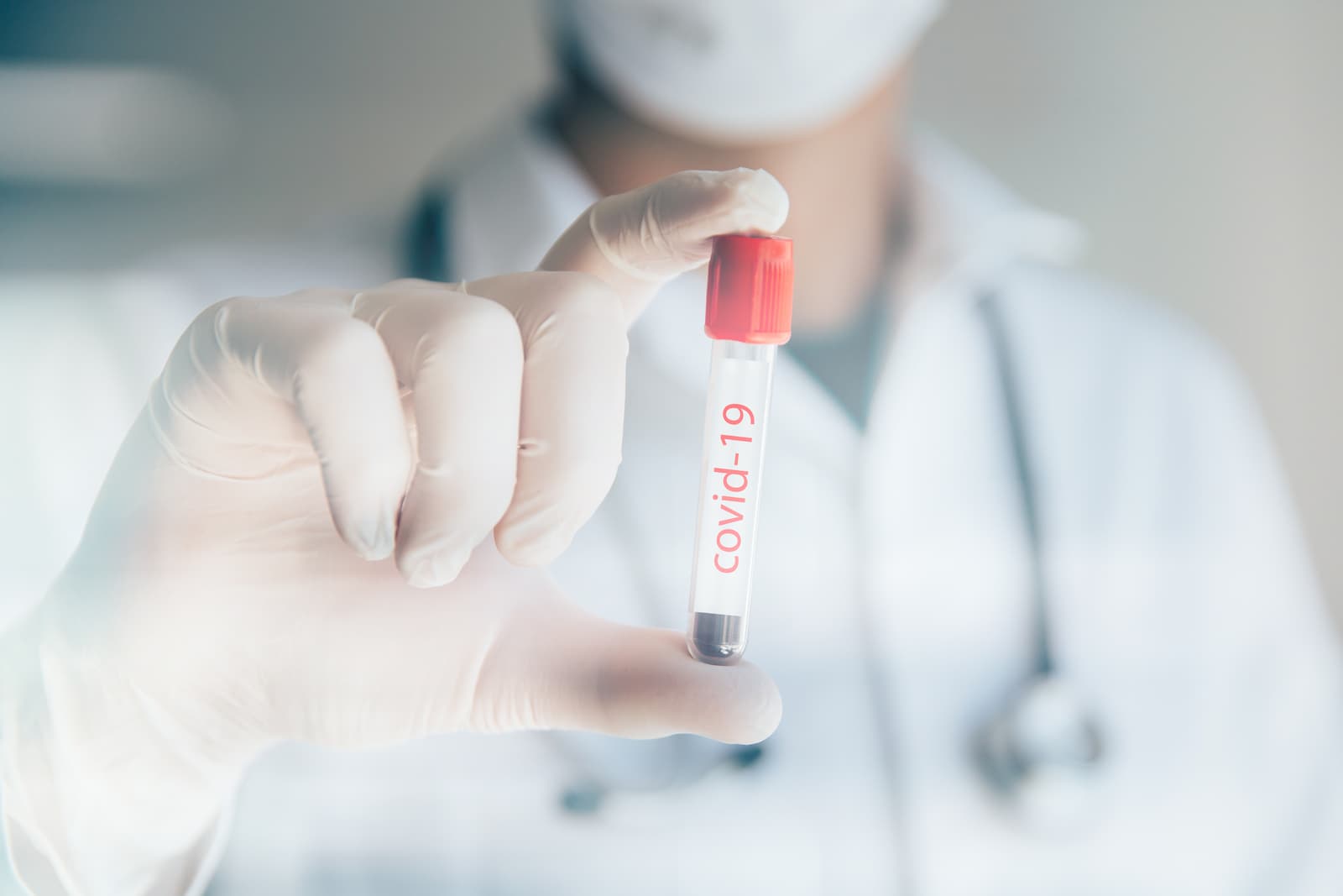 COVID-19: MoPH announces 151 new cases and 200 new recoveries