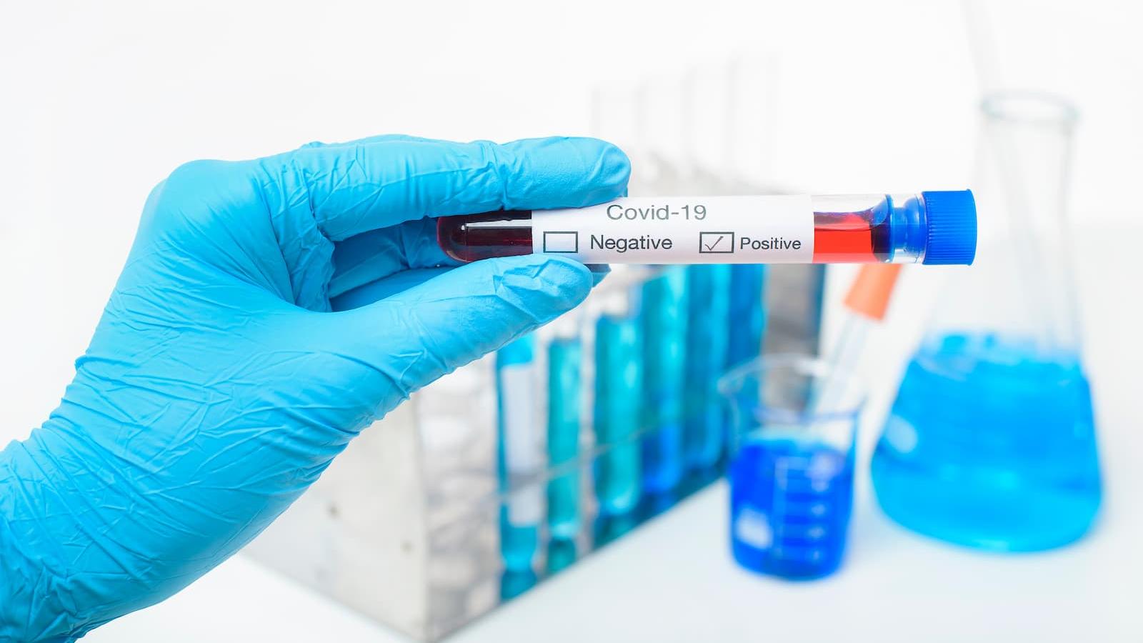 COVID-19: MoPH announces 142 new cases, 137 new recoveries, and one death