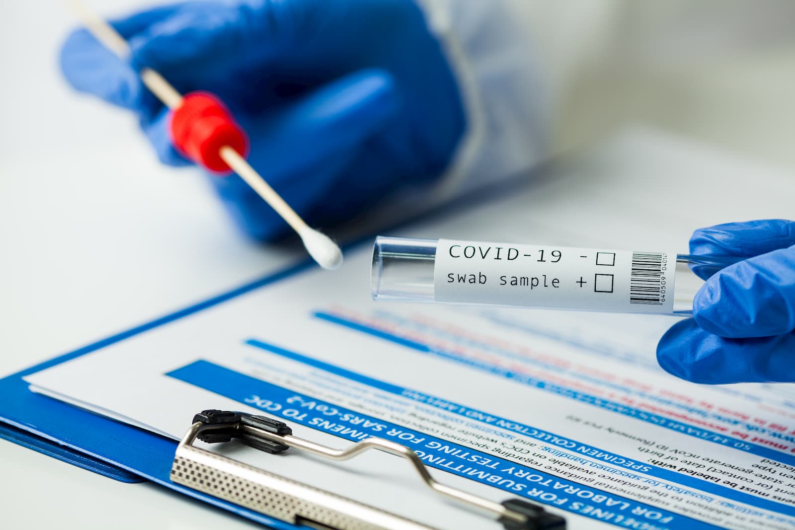 COVID-19: MoPH announces 398 new cases, 153 new recoveries and one death