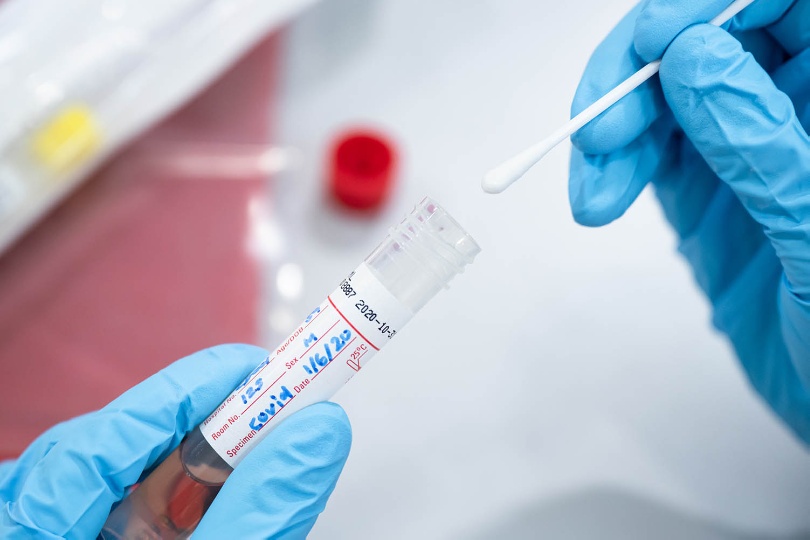 COVID-19: MoPH announces 408 new cases and 151 new recoveries