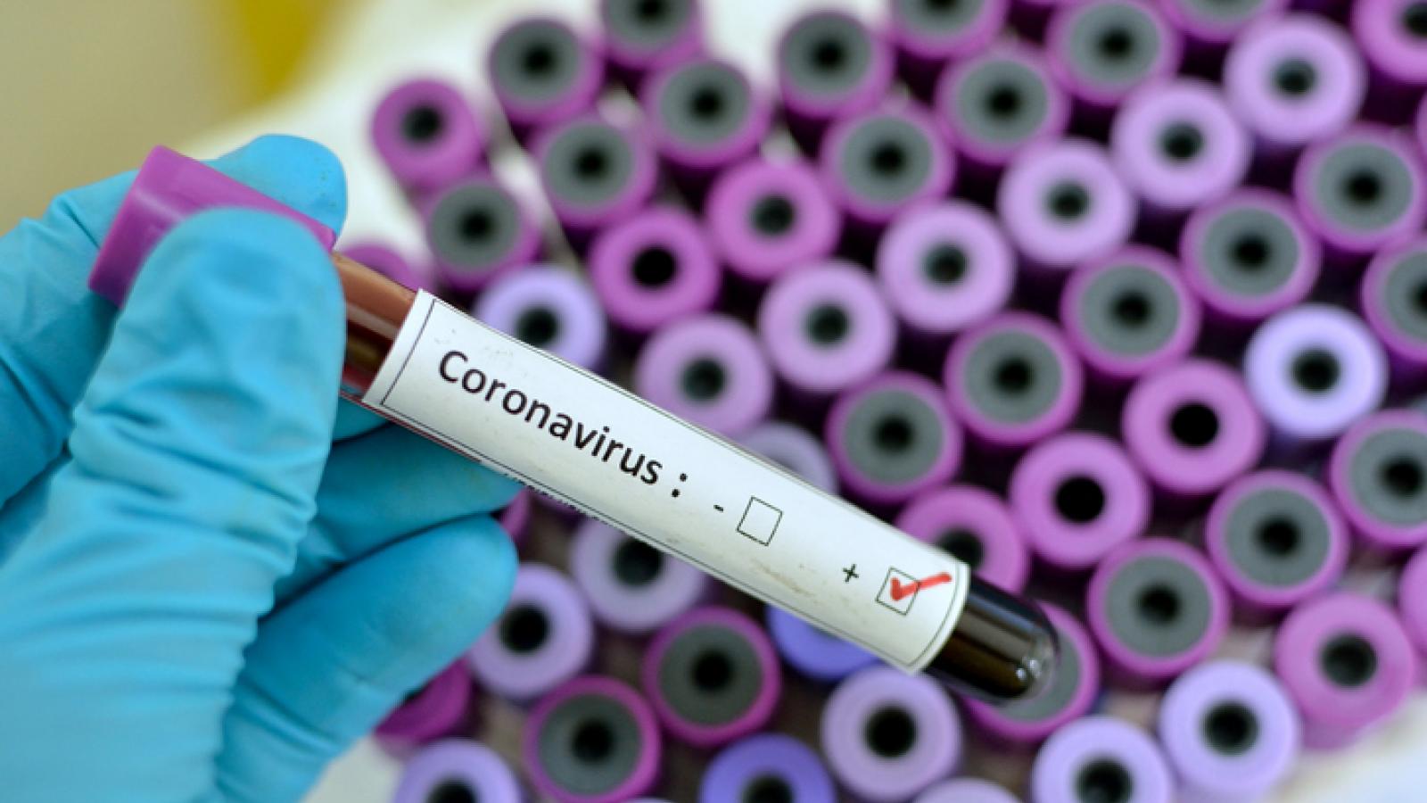 COVID-19: MoPH announces 453 new cases, 198 new recoveries, and one death