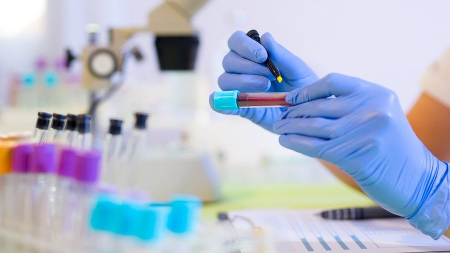 New blood test detects 96.4% of breast cancer cases in early study