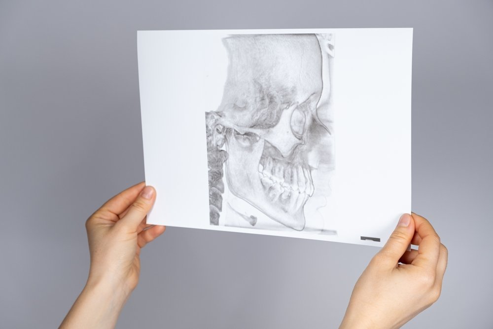 HMC introduces advanced keyhole surgery for jaw-joint disorders