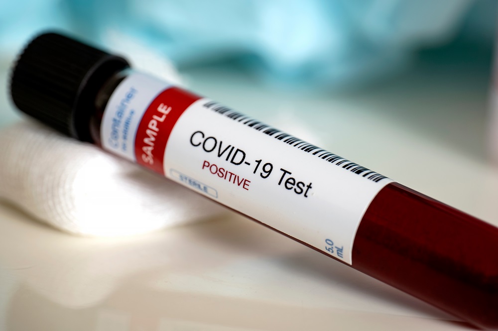 COVID-19: MoPH announces 1733 new cases, and 213 new recoveries