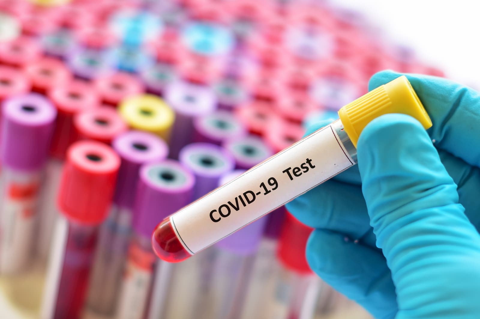COVID-19: MoPH announces 530 new cases, 1804 new recoveries and two deaths