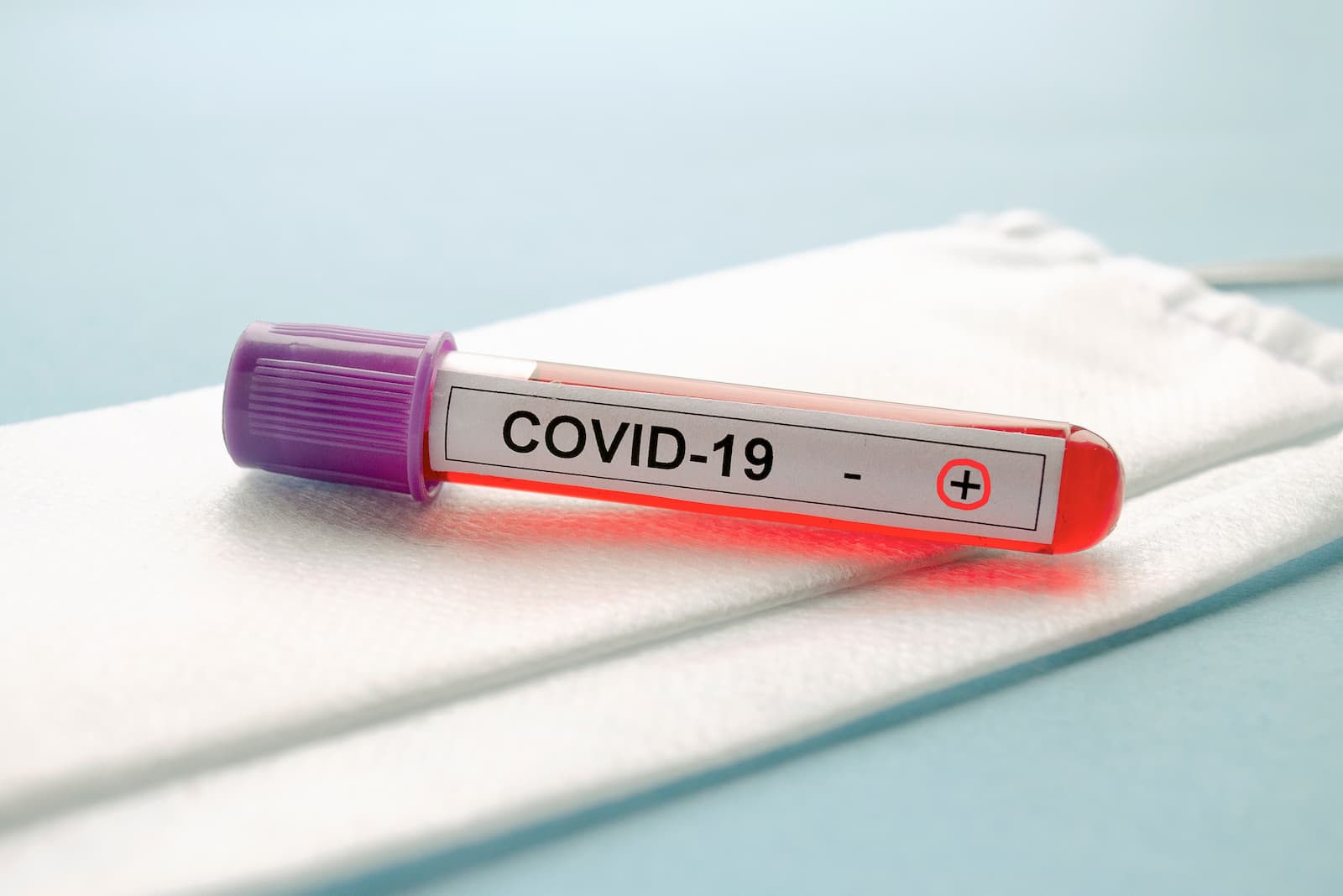COVID-19: MoPH announces 450 new cases, 477 new recoveries and one death