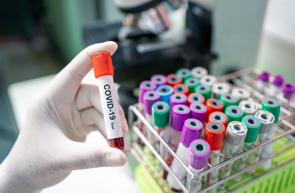 COVID-19: MoPH announces 196 new cases, 201 new recoveries and three deaths