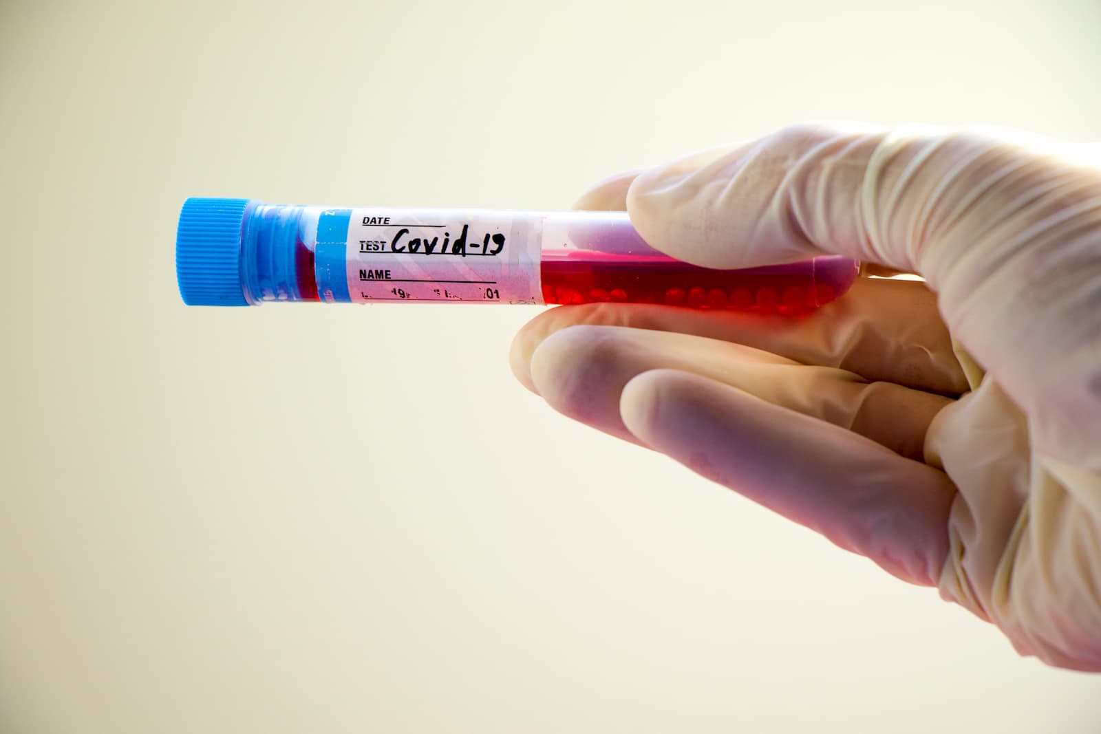 COVID-19: MoPH announces 189 new cases and 204 new recoveries