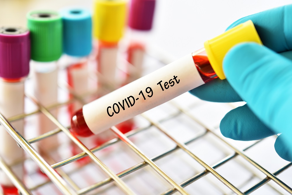 COVID-19: MoPH announces 174 new cases and 186 new recoveries
